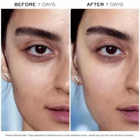 Lancôme – Sérum Advanced Génifique Anti-Age - LANCOME