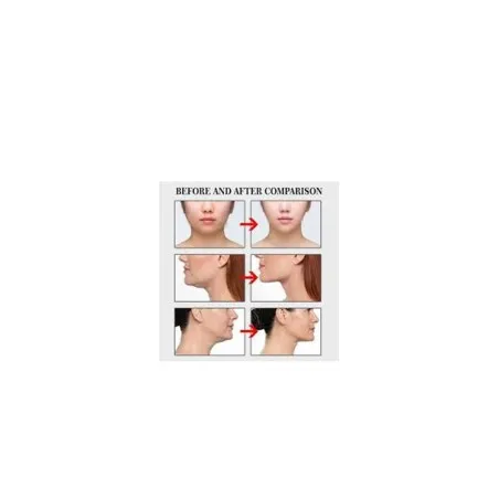 40 Patch De Lifting Visage JAYSUING - JAYSUING